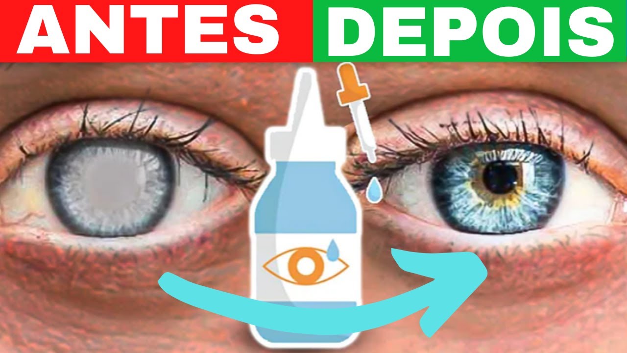 O MELHOR REM&Eacute;DIO PARA CATARATAS | TRATAMENTO NATURAL E CASEIRO PARA CATARATA | Doutor Jo&atilde;o