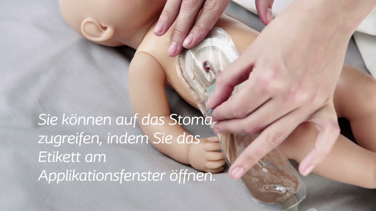 Anwendungsanleitung SenSura Mio® Baby - für Fachpersonal pädiatrische Pflege
