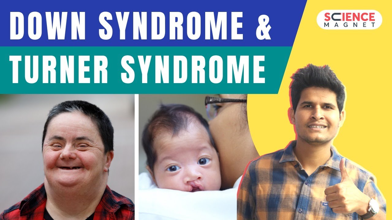 Down Syndrome & Turner Syndrome by Neeraj Sir #biology #neerajsir #sciencemagnet