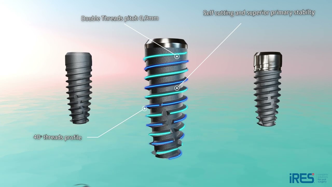 iRES Volution Implant 3D Animation Swiss Made