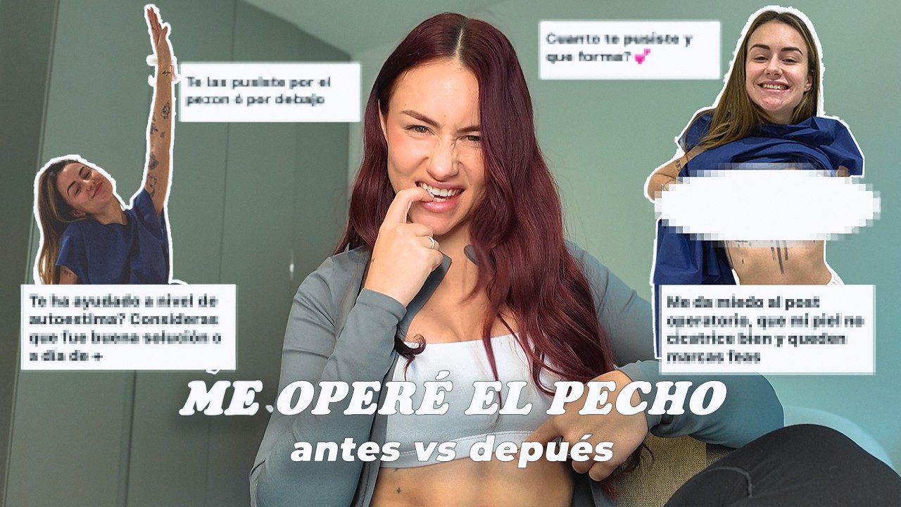 La Realidad de Operarte el Pecho (Nadie habla de Esto)
