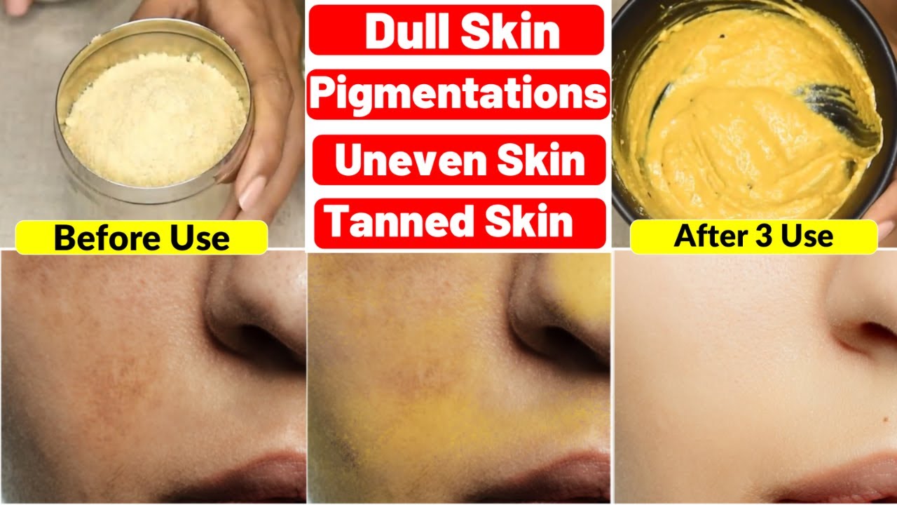 I tried World's Fastest Skin Brightening DIY Facewash Powder-Got Even Bright Glowing Skin in 3 Days