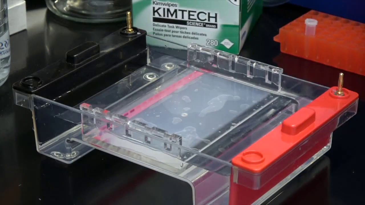 Electroforesis en gel de agarosa
