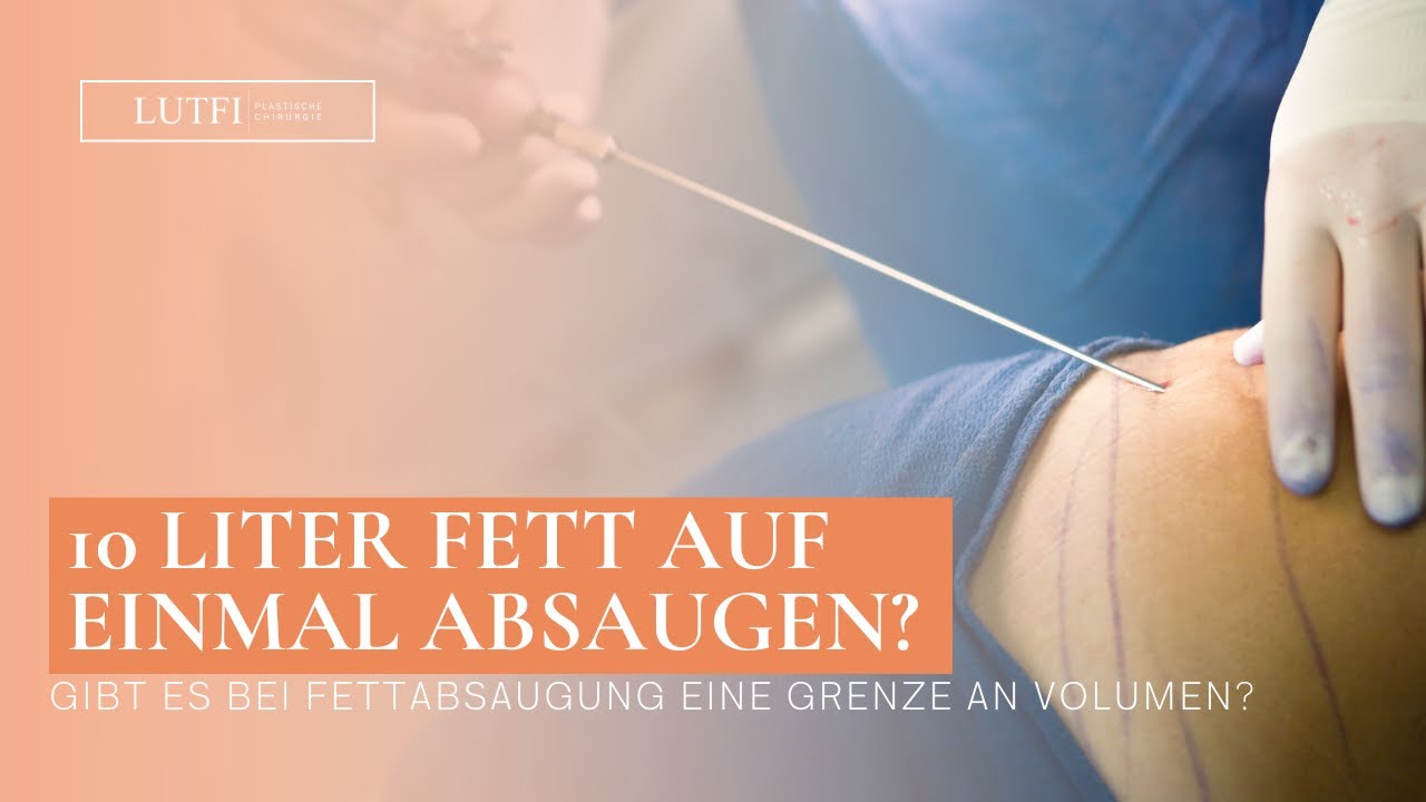 Fettabsaugung- So viele Liter kann man auf einmal absaugen.