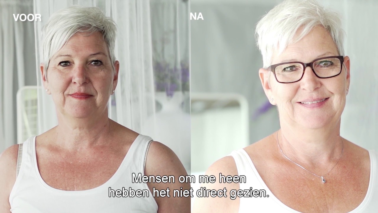 Spiegeltje, Spiegeltje - Fillers