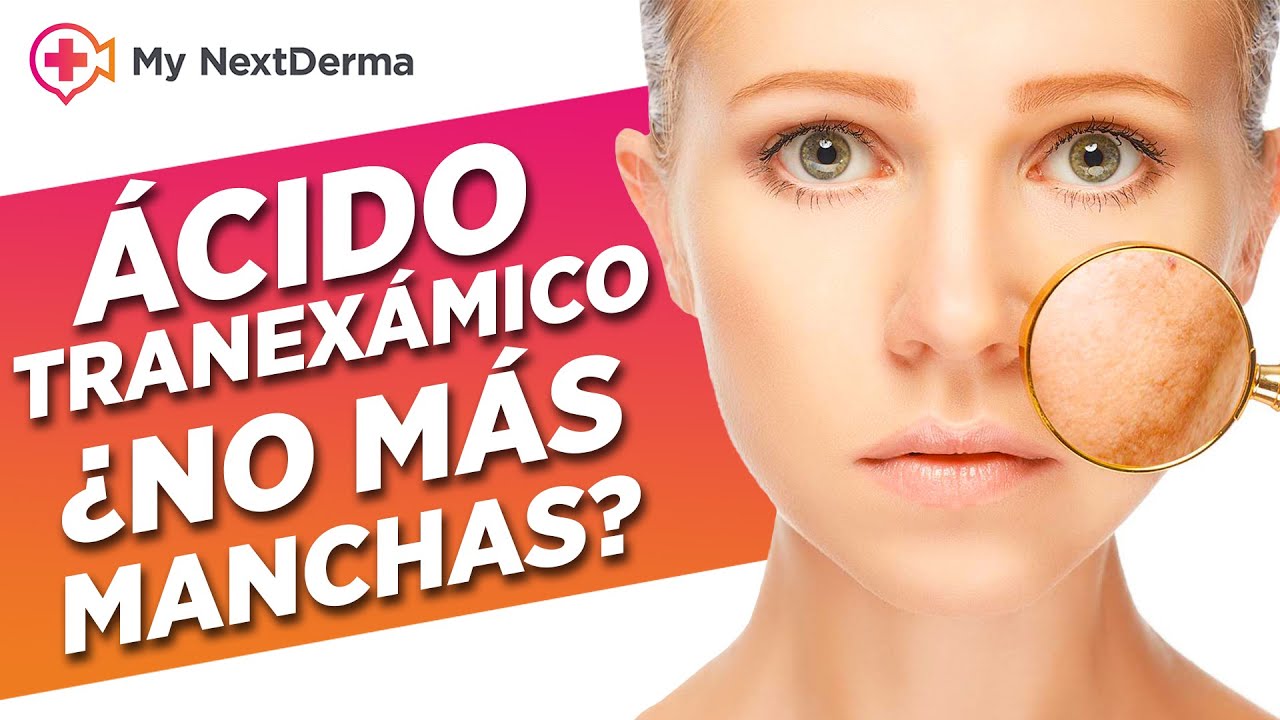 ¿Piel MANCHADA? Ácido Tranexámico, la otra opción para combatir las manchas en la piel.