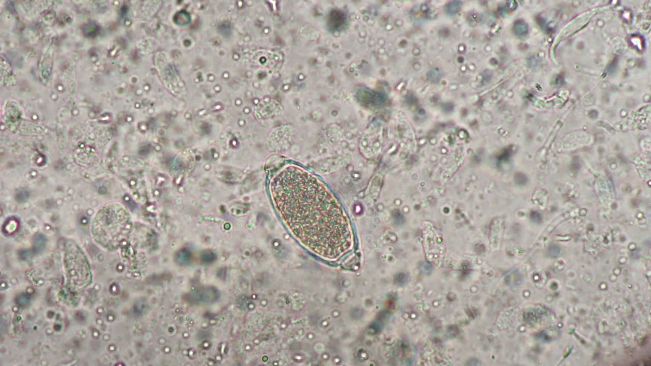 Trichuris vulpis y Capilaria plica. CIAB. www.ciab.es.