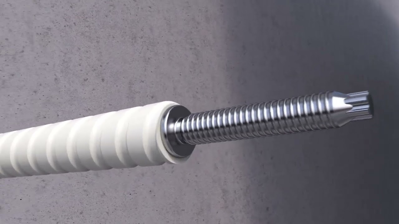 Nadčasové řešení fasády - Schöck Isolink®