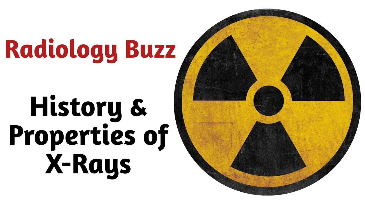 History and Properties of X-Rays