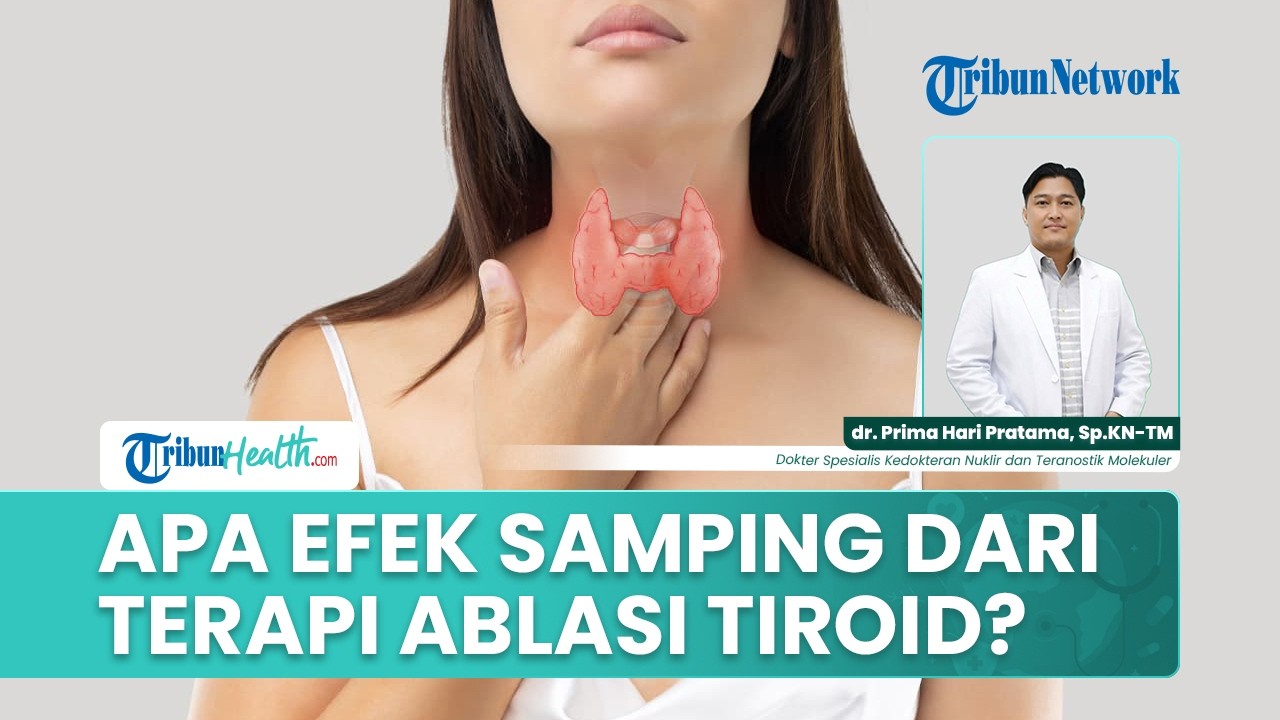 Efek Samping Setelah Ablasi Tiroid yang Perlu Diketahui Pasien serta Cara Aman Menjalani Pemulihan