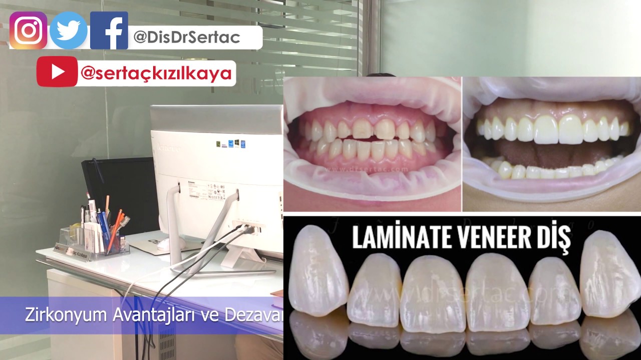 Zirkonyum diş kaplama neden tercih edilir? Porselen diş kaplama ile karşılaştırılması. Fiyatı ne