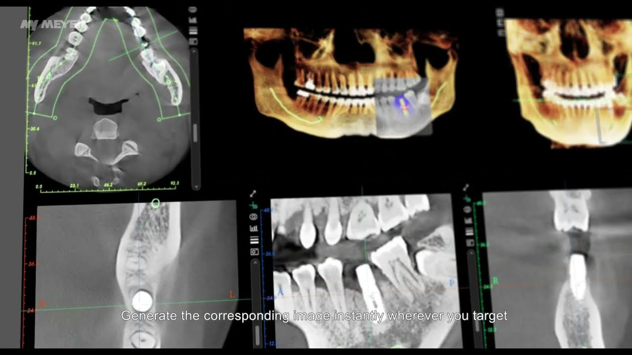 MyDent Viewer - 3D Panoramic