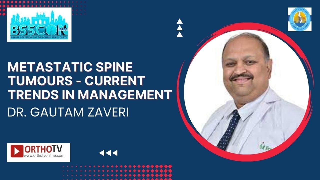 BSSCON 2022 : Metastatic Spine Tumours - Current trends in Management - Dr. Gautam Zaveri