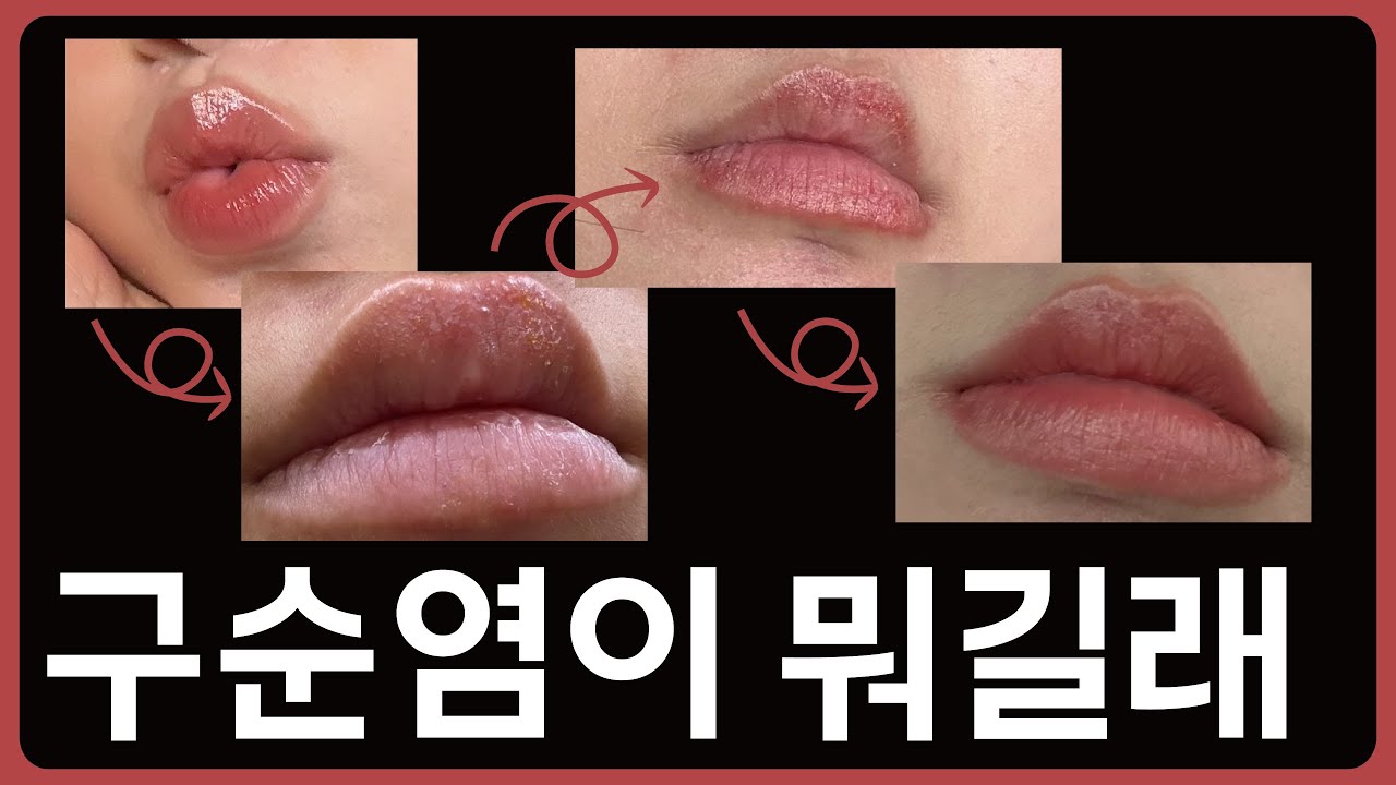 인생 최고 화장이 최악이 되기까지 오버립 절망편 #오버립 #구순염 #절망편