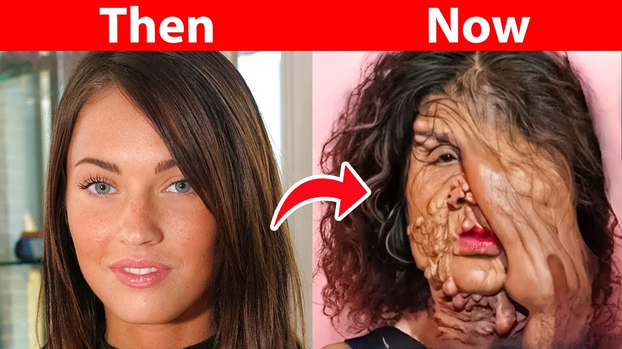 This is How These Stars Transformed Because of Plastic Surgery!