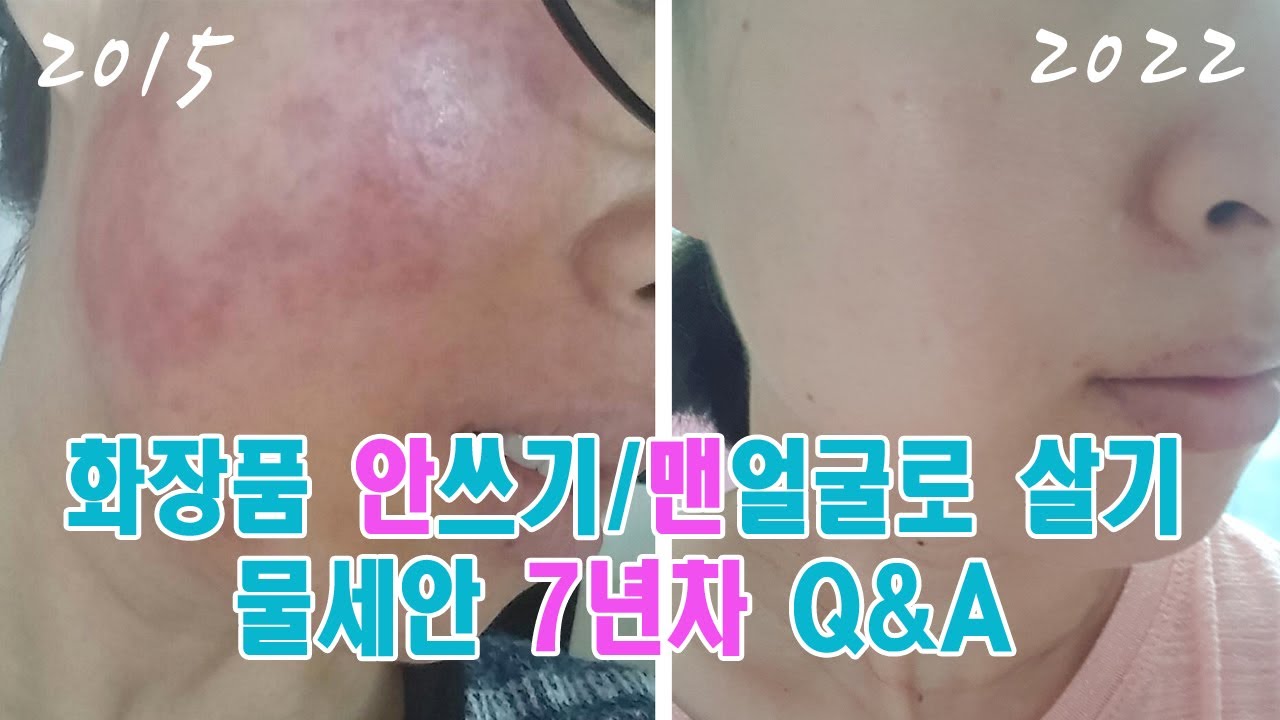 [물세안 7년차 Q&A] 화장독 없애기/피부염/물세안 방법/화장품 안쓰기/물세안 썬크림 궁금타파!!