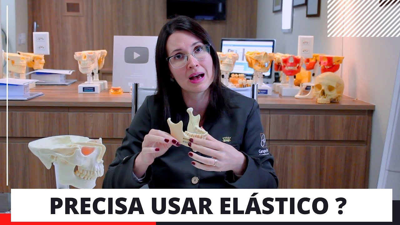 USO DE ELÁSTICO NO PÓS OPERATÓRIO DA ORTOGNATICA  - DRA. DANIELLE SALES