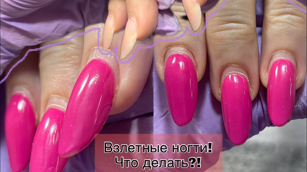 Коррекция на вверх растущие ногти/Как опилом исправить взлетные ногти/пропилы
