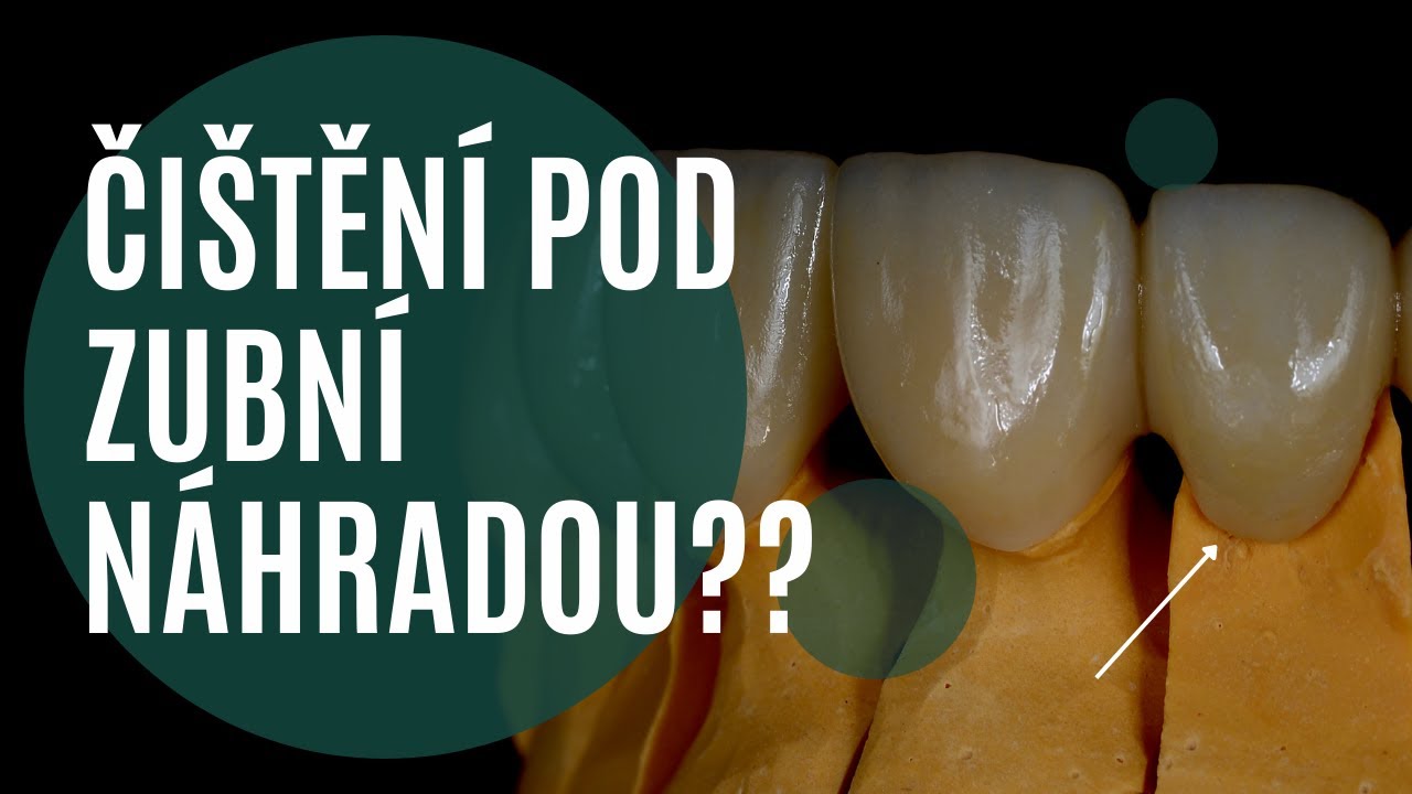 👀🦷 Čištění pod zubní náhradou, je to zapotřebí?