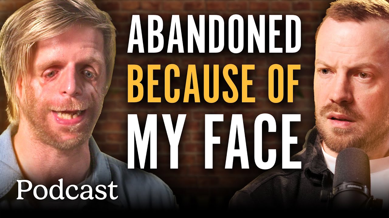 Abandoned At Birth And Bullied: How I Learnt To Love My Face | Minutes With Podcast | @ladbiblestories