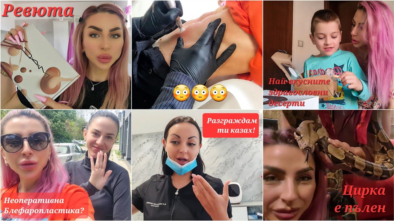 Циркът е Пълен ▪ Неоперативна Блефаропластика ▪ Разградих си Устните Отново ▪ Много Ревюта