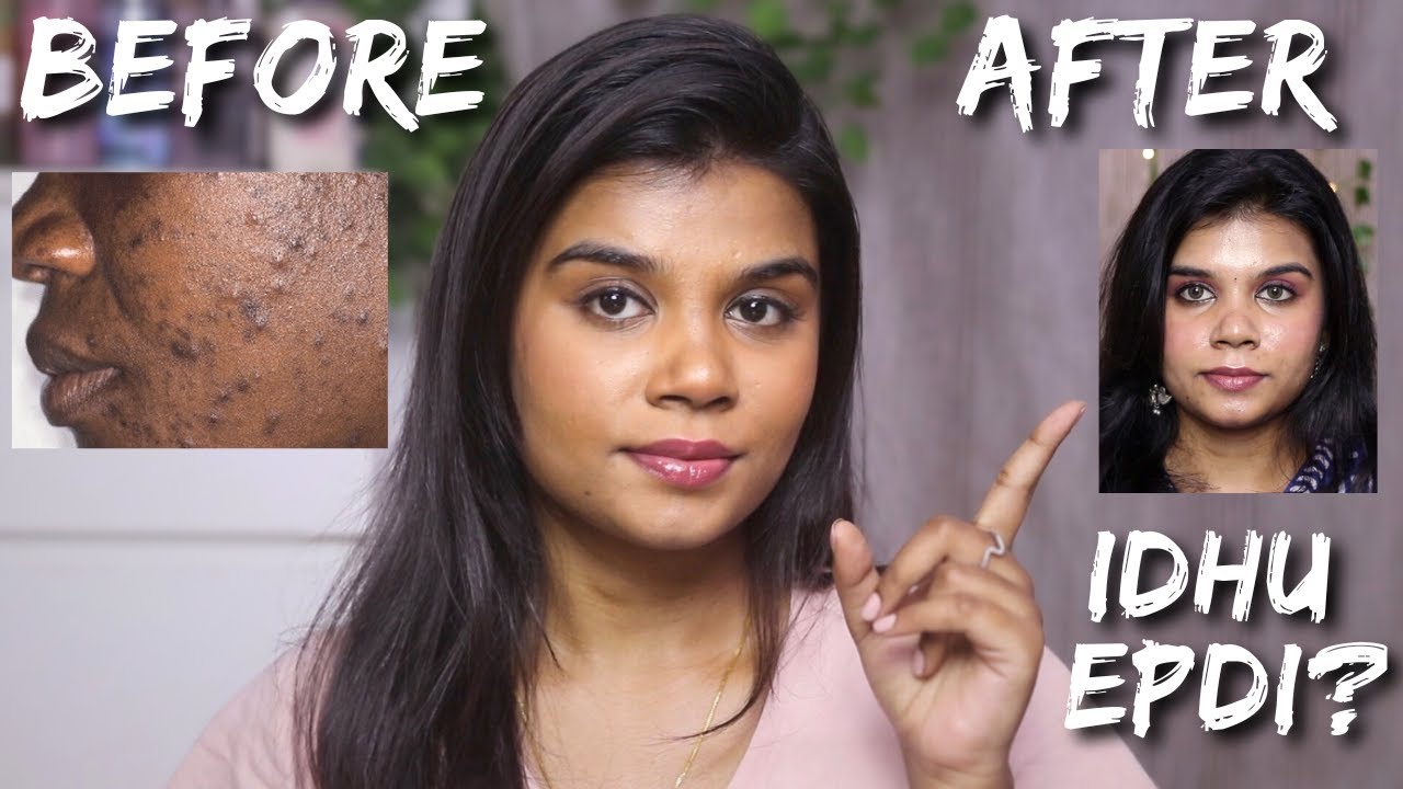 GLOWING SKIN SECRETS | SKINCARE | VITAMIN C | PIGMENTATION | REDUCE DARK SPOTS| CHICNUTRIX OUTSHINE
