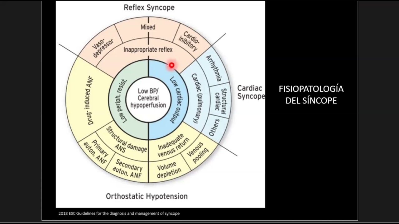 Sincope