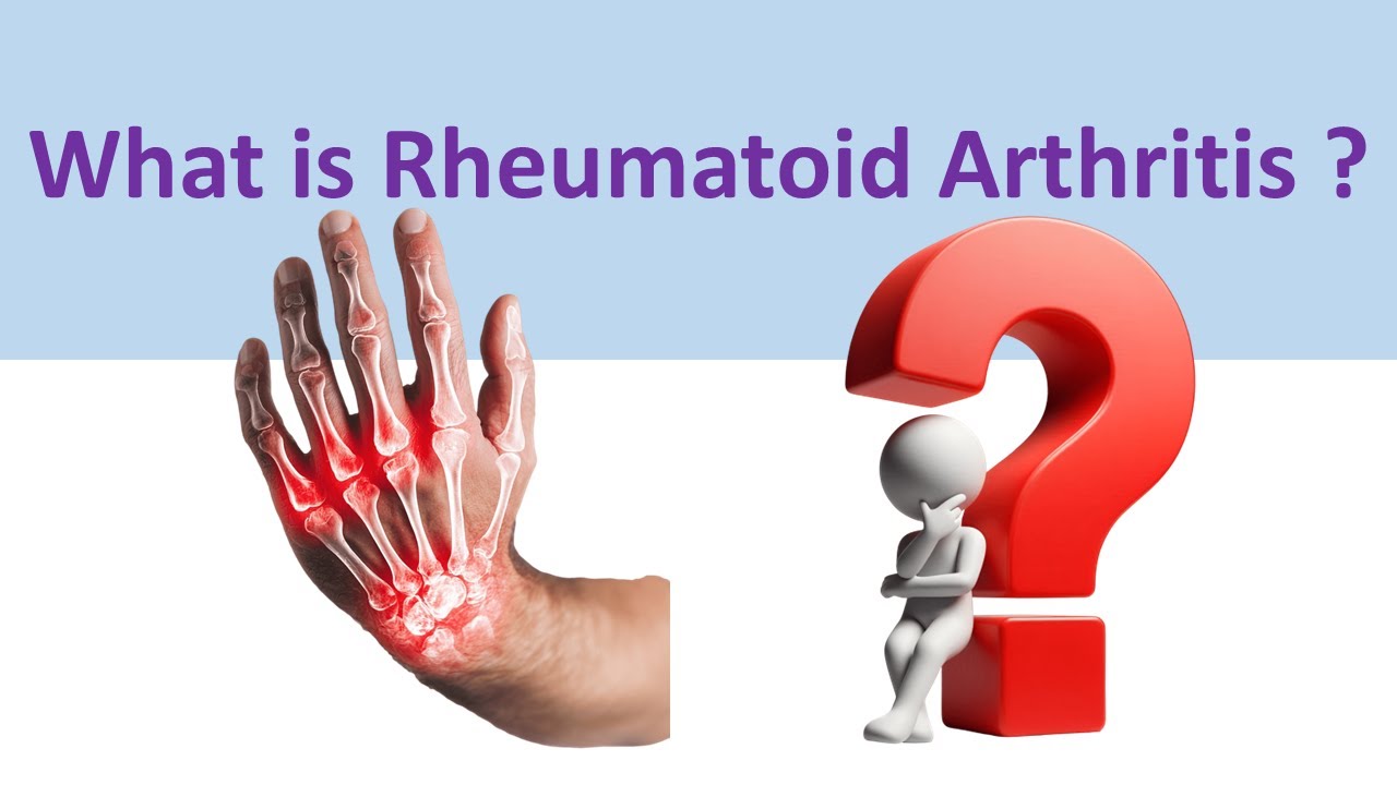 What is Rheumatoid Arthritis ?  रूमेटोइड आर्थराइटिस (गठिया) रोग क्या है ?