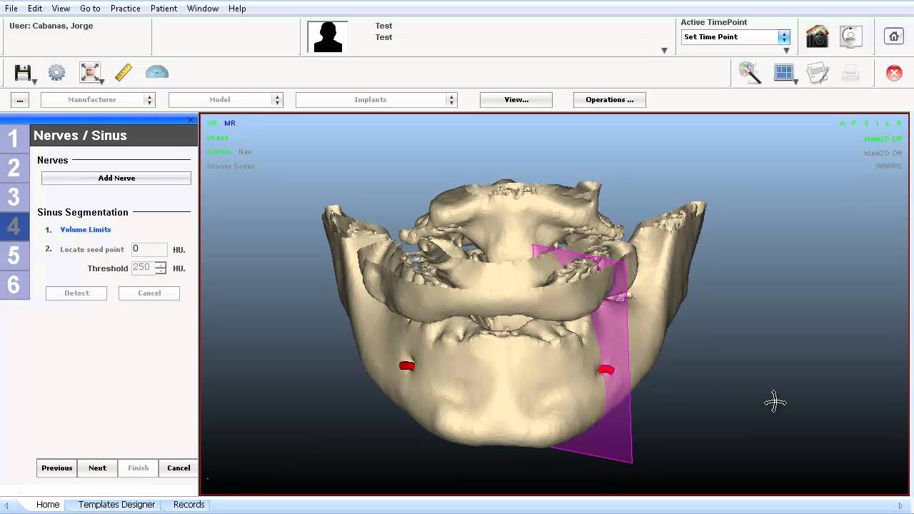 NemoScan Implantology v10