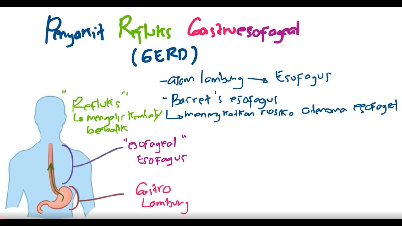 Patofisiologi - Penyakit Refluks Gastroesofageal (Gastroesophageal reflux disease/ GERD)