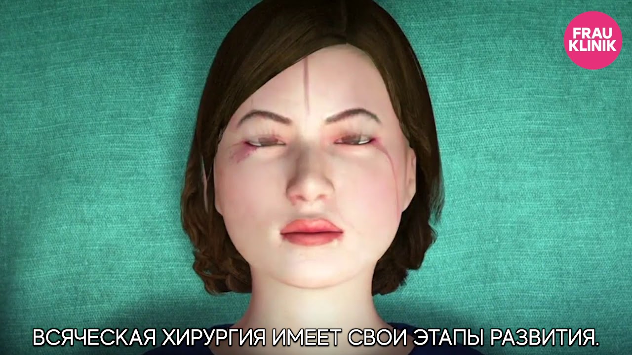 Пересадка лица!
