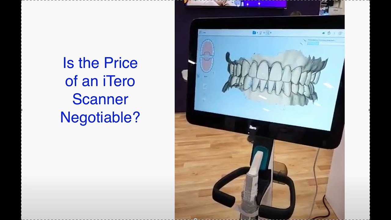 Is the Price of an iTero Scanner Negotiable?