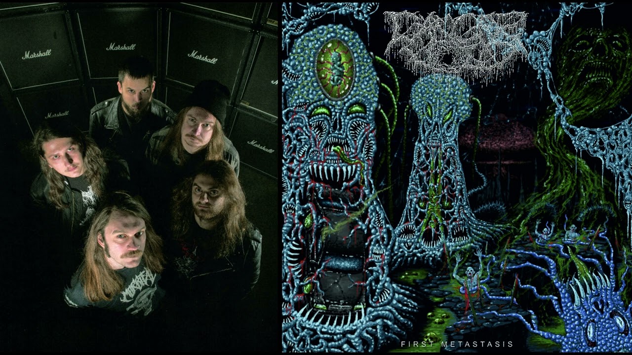Cancer Void (Cze) - First Metastasis (Album 2025)