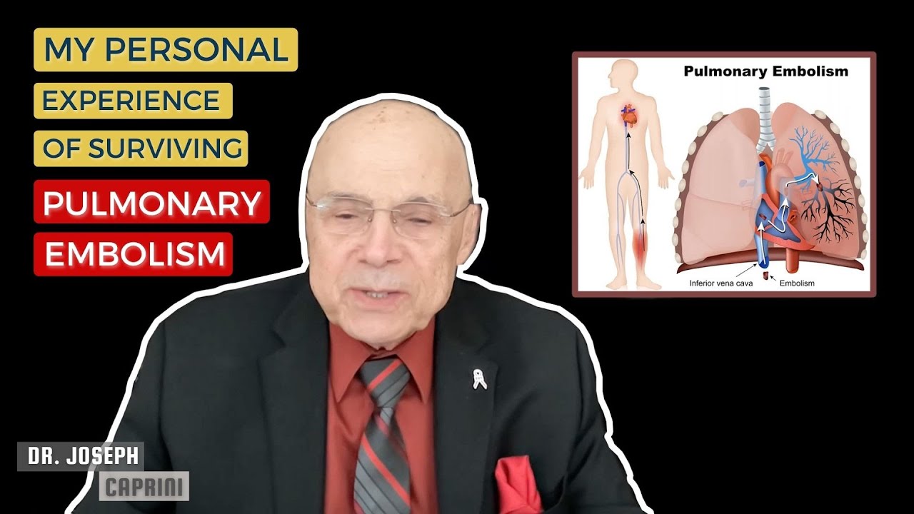 Pulmonary Embolism: Seen Through The Eyes of A Professor/Patient