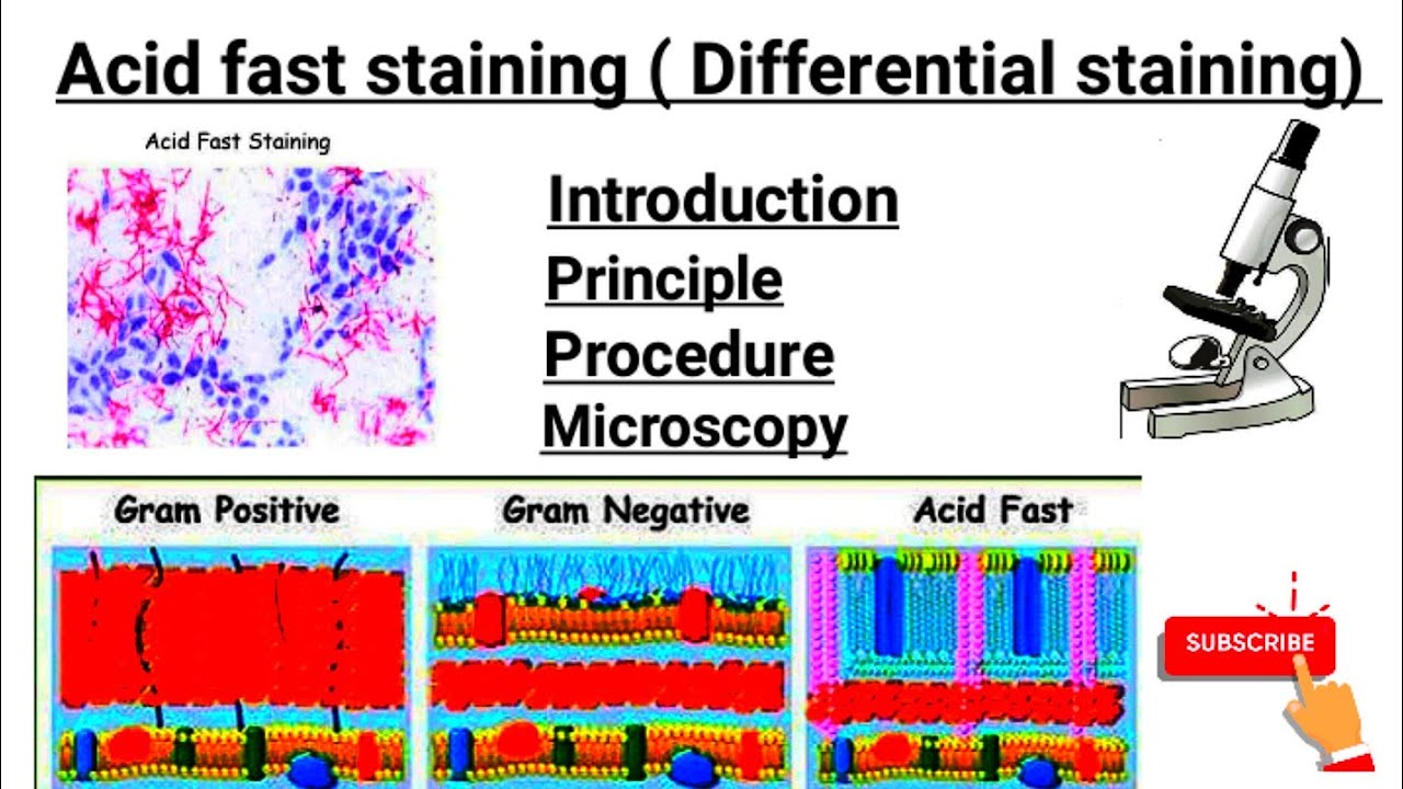 Acid fast staining  part -3 | Introduction | principal | Procedure | Microscopy