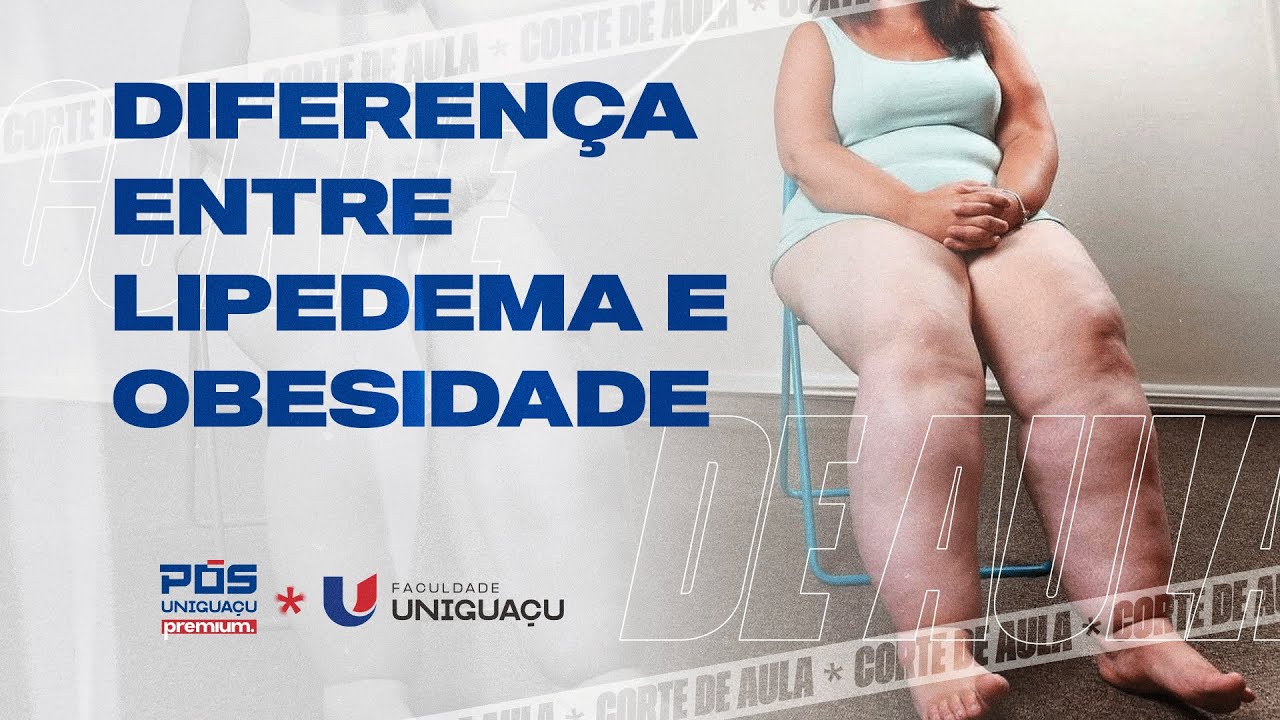 Como diferenciar LIPEDEMA de OBESIDADE? VEJA AGORA – Dra. Aline David, PhD.