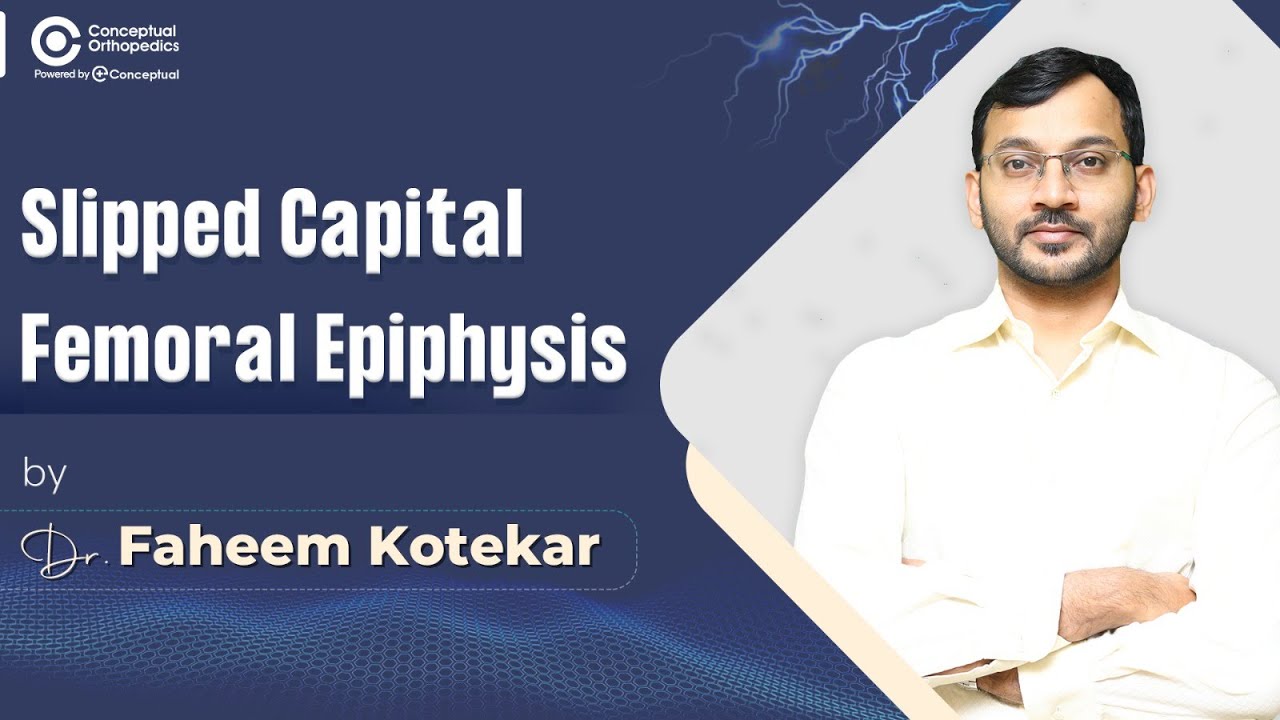 Slipped Capital Femoral Epiphysis by Dr.Faheem Kotekar