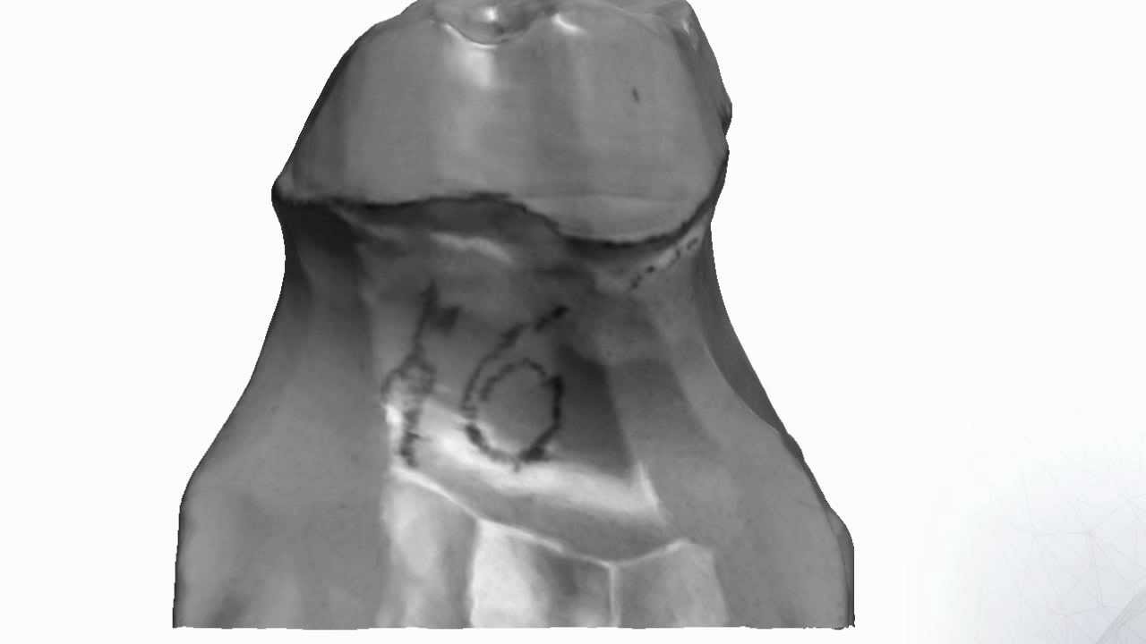 Dental System&trade; 2012 - Texture Scanning