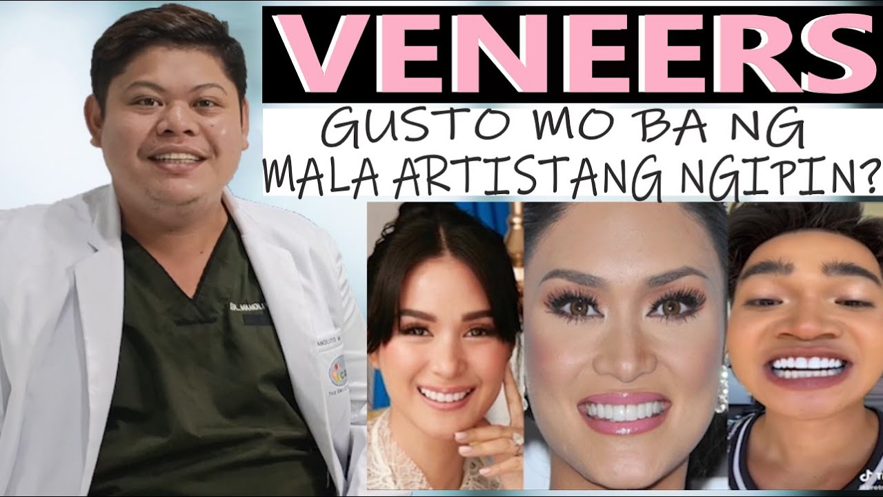 VENEERS | WHAT ARE DENTAL VENEERS? | VENEERS PROCEDURE | Doc Noy