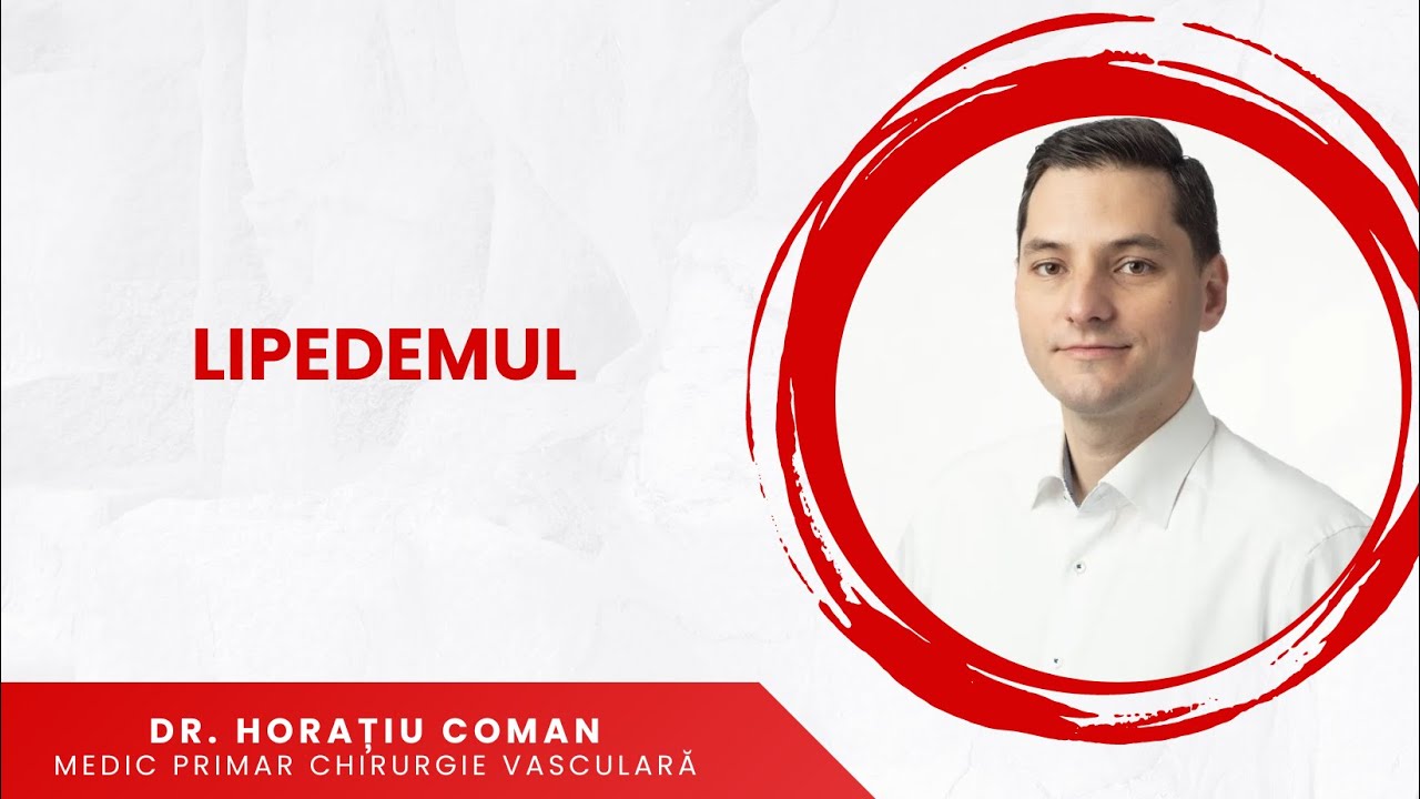 Ce este lipedemul? I Dr Horațiu Coman
