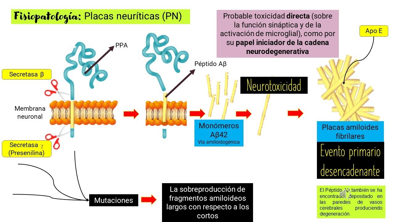 Alzheimer FISIOPATOLOGÍA