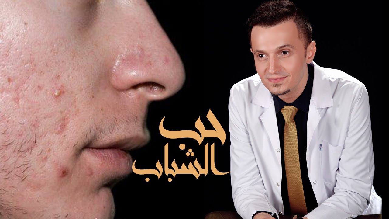 حل مشكلة حب الشباب - انت تعرف_How to remove the acne