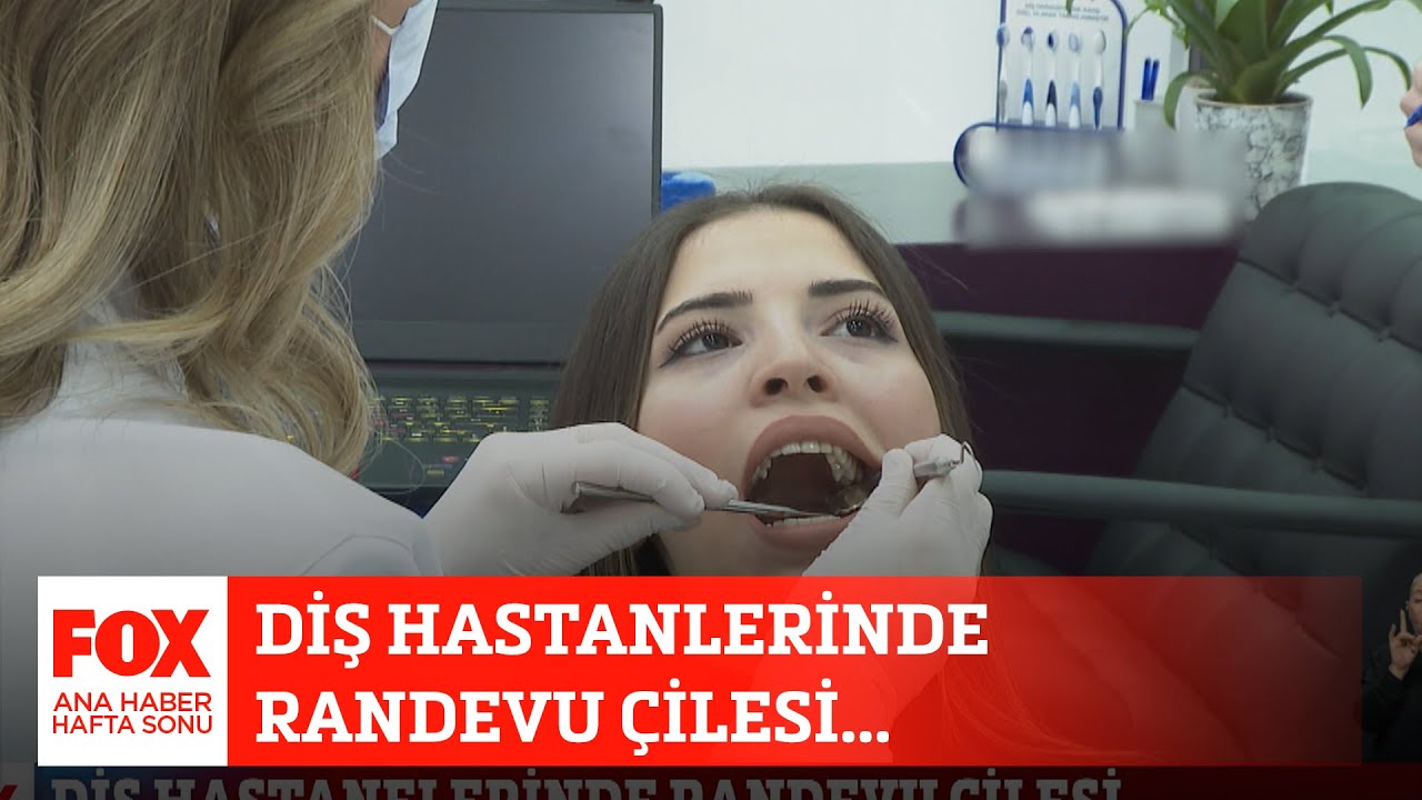 Diş hastanelerinde randevu &ccedil;ilesi... 30 Temmuz 2022 FOX Ana Haber Hafta Sonu