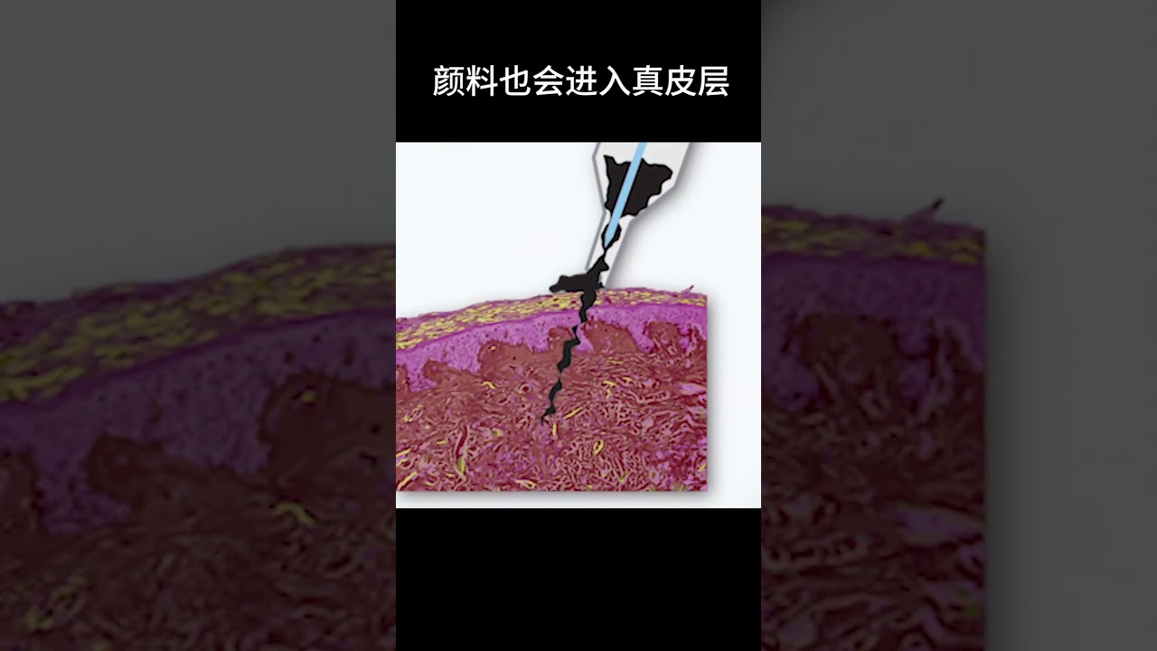纹身到底有多可怕，慢镜头下找到了答案！#shorts