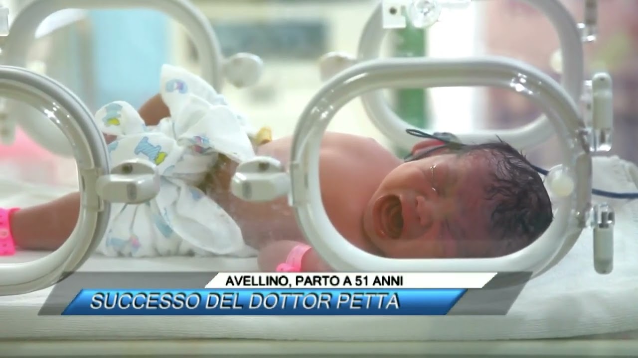 ✅ AVELLINO, PARTO A 51 ANNI: SUCCESSO DEL DOTTOR PETTA |SUD TV 114|