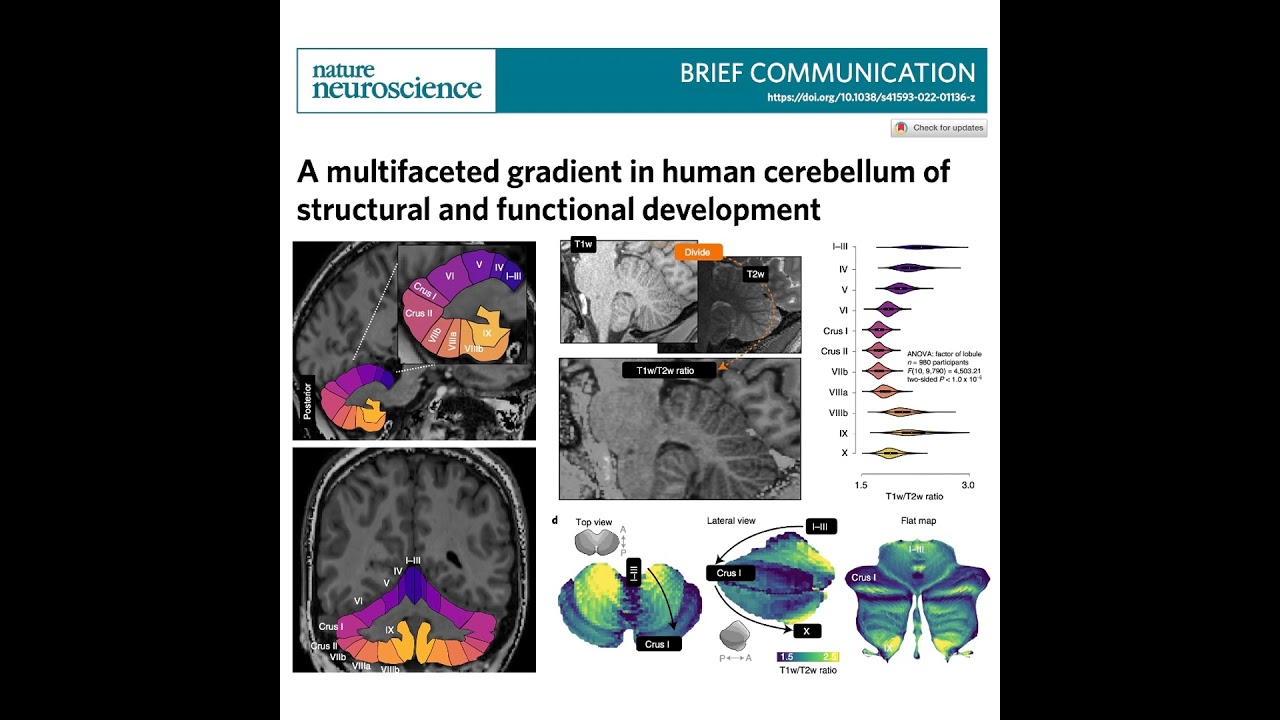 616-Gradients of Structural Human Cerebellar Development