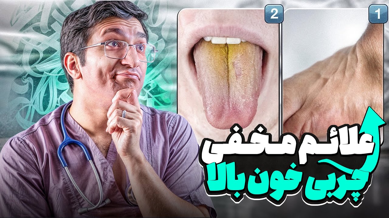علائم مخفی چربی خون بالا