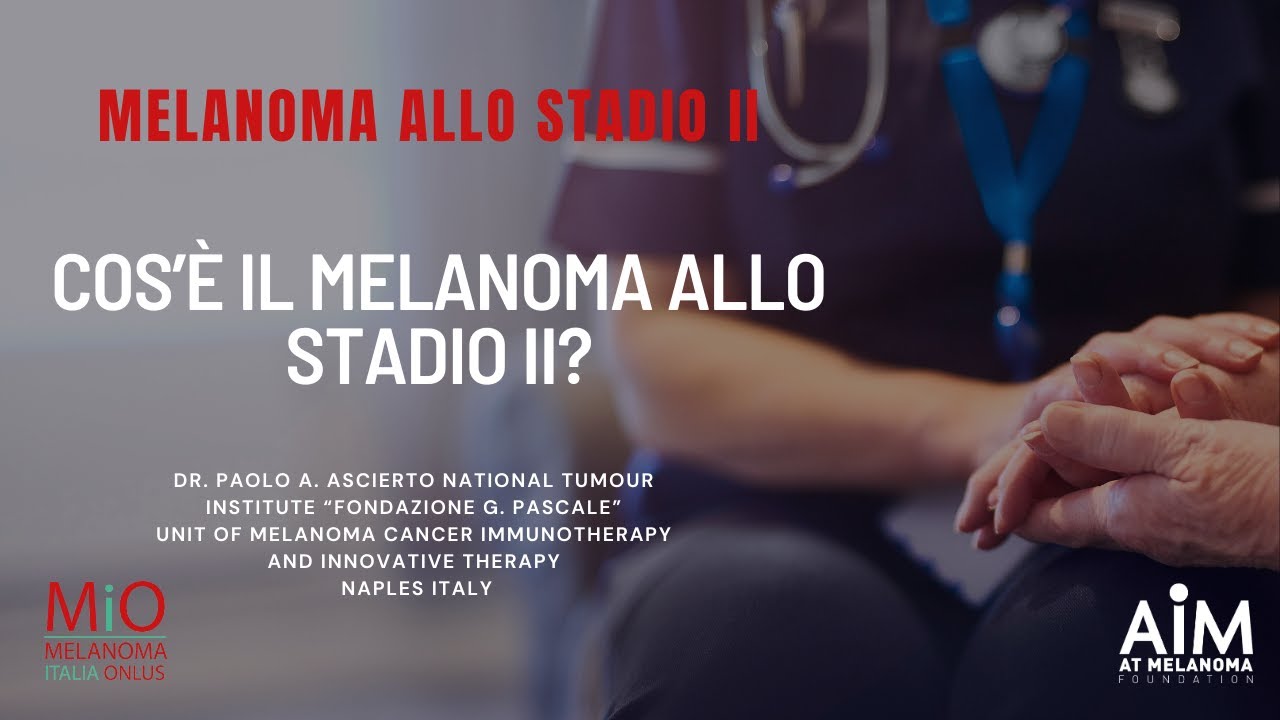 Cos’è il melanoma allo stadio II?