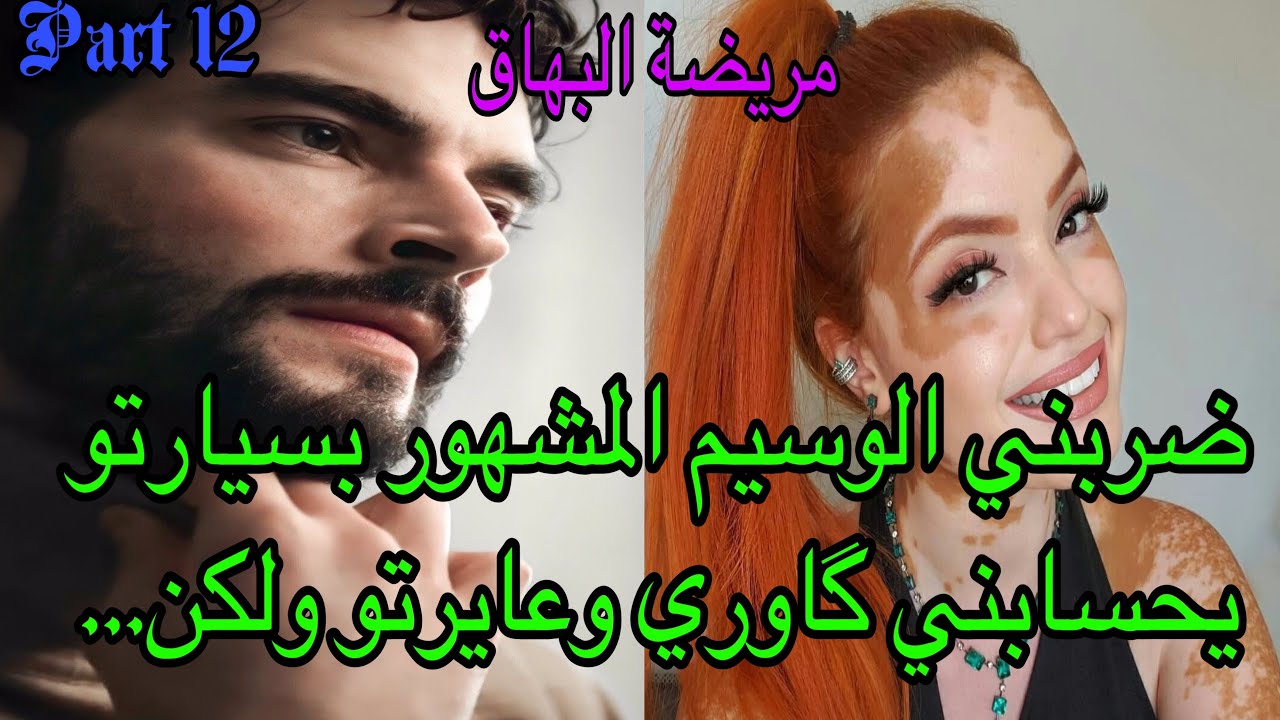 1️⃣2️⃣ضربني بسيارتو 🤨عايرتو بالدارجة يحسابني گاوري🤣أحبني المشهور الوسيم وأنا مريضة البهاق 😍