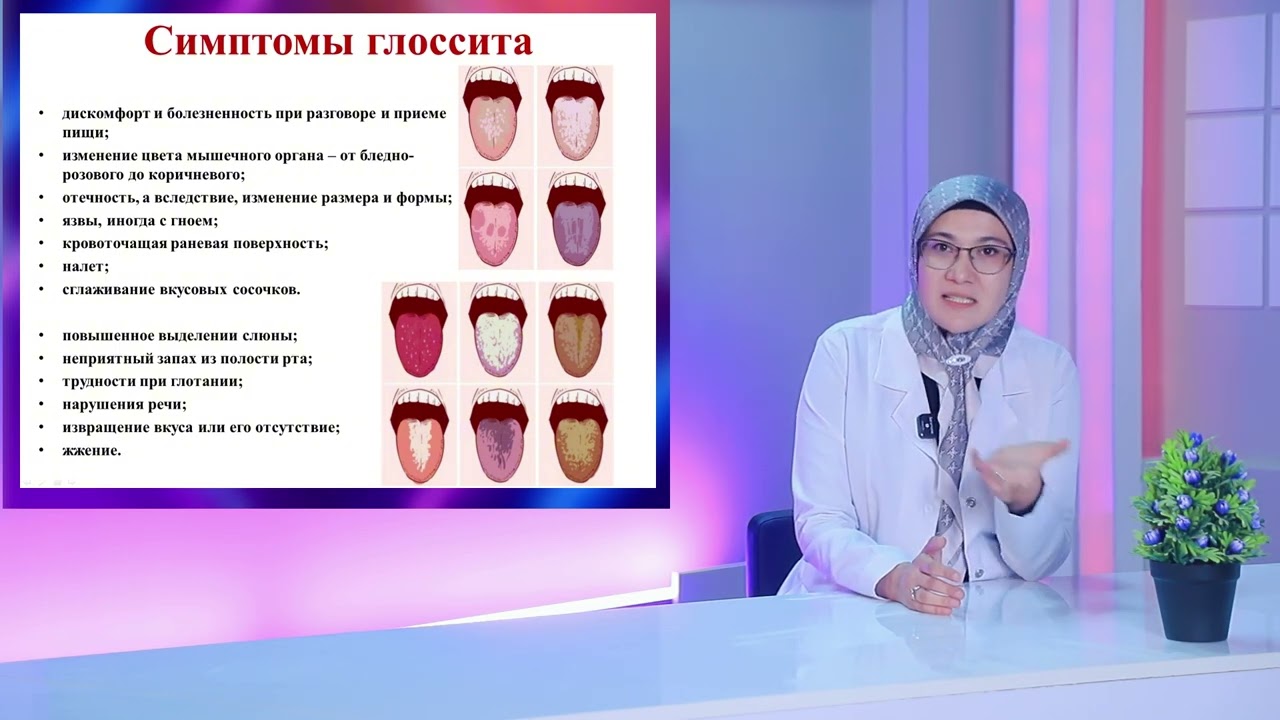 Глоссит (воспаление языка): причины, симптомы, диагностика и лечение